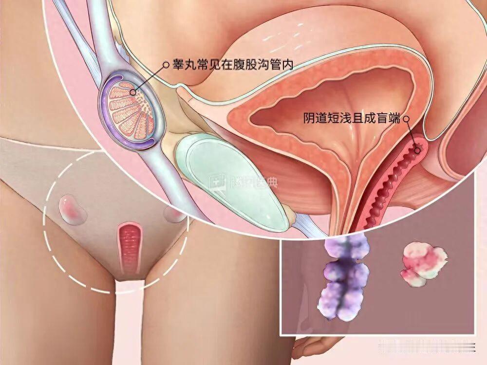 “万万没想到！”深圳，26岁的女子从来都没有来过月经，去医院检查才明白，自己原本