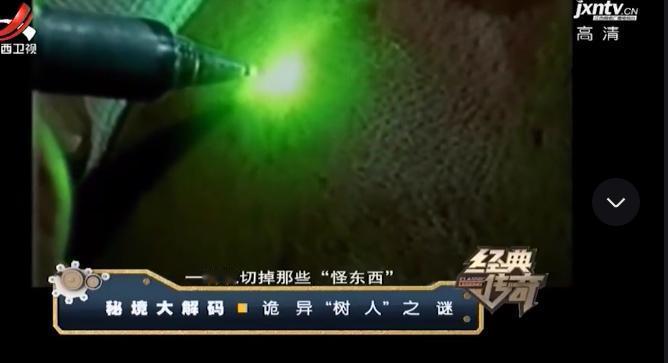 “我快要疼死了！”1992年，湖南小伙半夜惊醒，浑身火急火燎的疼，他开灯仔细一看