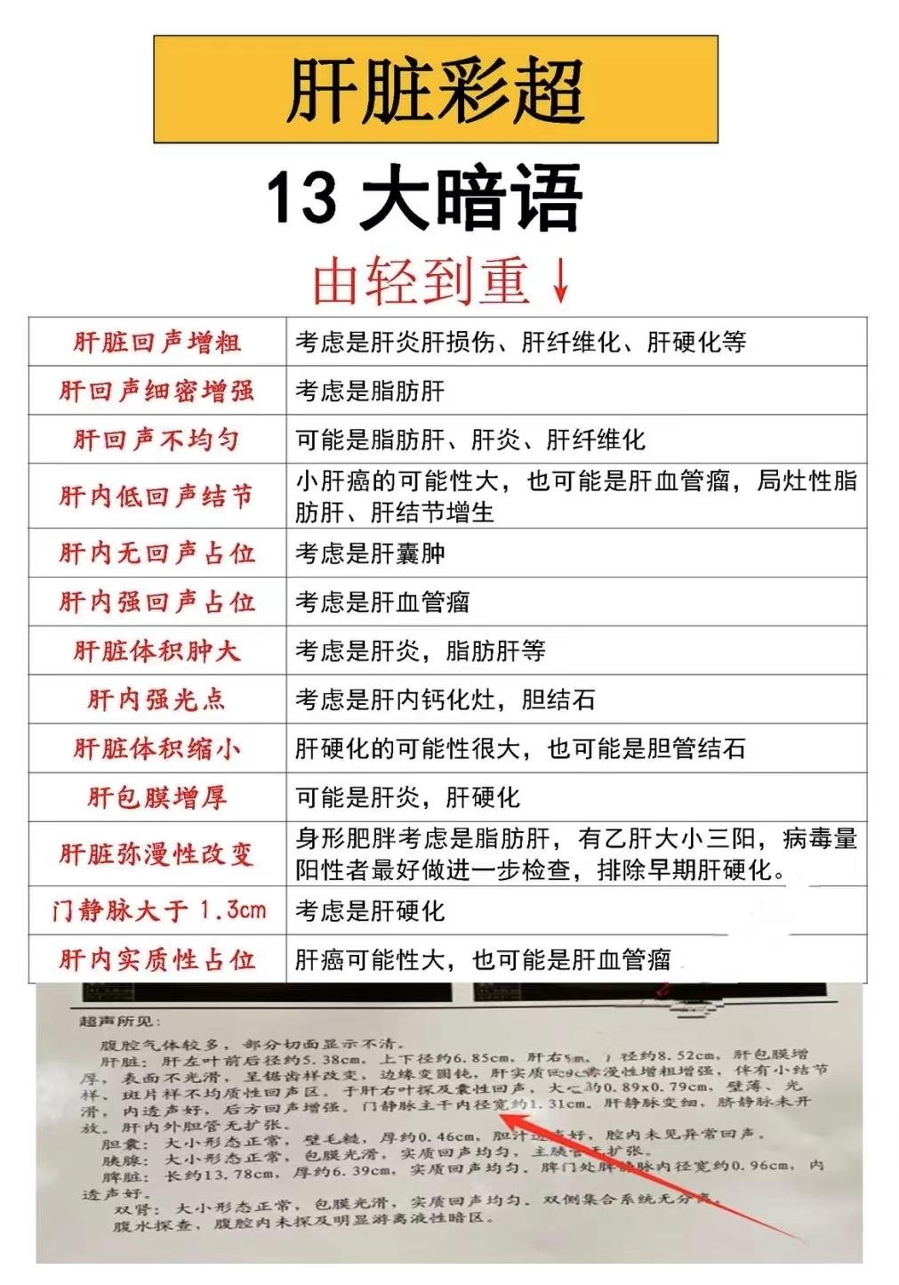 肝脏彩超13大暗语，由轻到重！