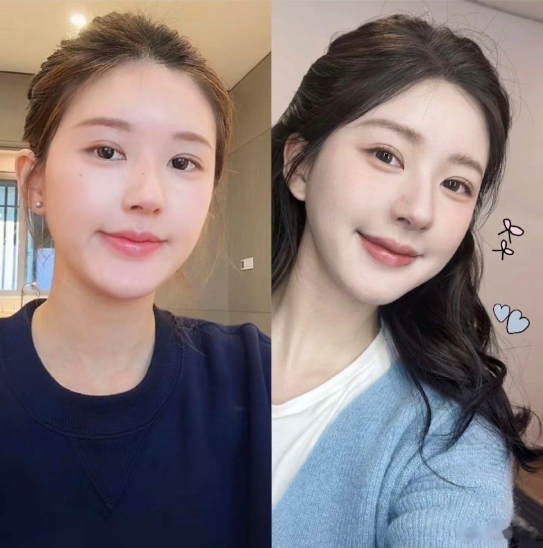 赵露思生病的那段时间，眼神都看上去很疲惫无神。现在状态好了，眼神正常了 化妆也正