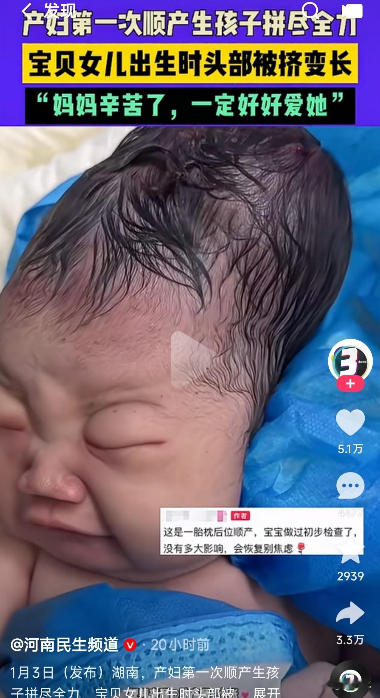 女子第一次顺产生孩子拼尽全力，宝贝女儿出生时头部被挤变长，网友们都担心这孩子长大