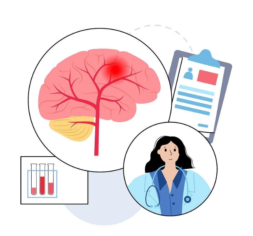 注意！脑出血有8大前兆，有些症状容易被忽视！1、头痛：突发且剧烈的头痛是最常见的