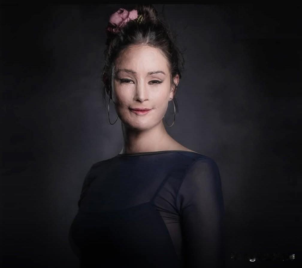 3岁那年，娜塔莉亚·庞塞（Natalia Ponce）被一名陌生人用一升硫酸袭击