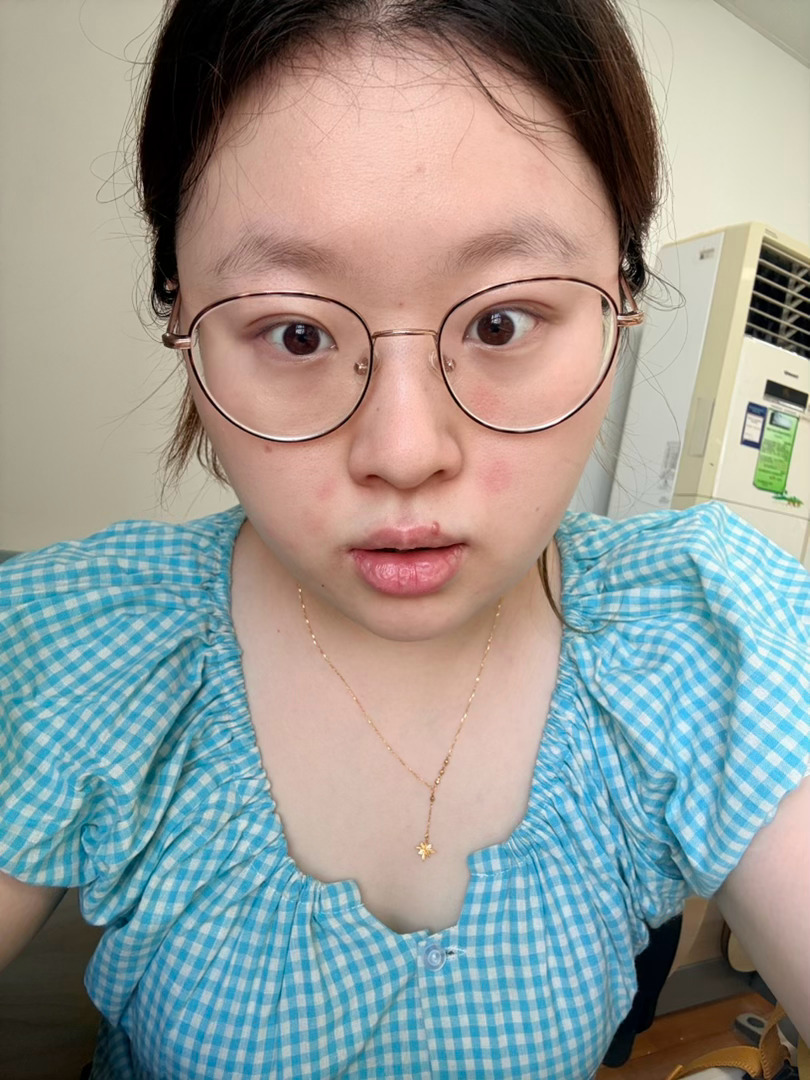 顶着大太阳来学校热的脸都过敏了 到了和我说今天的课不上。[怒] ​​​