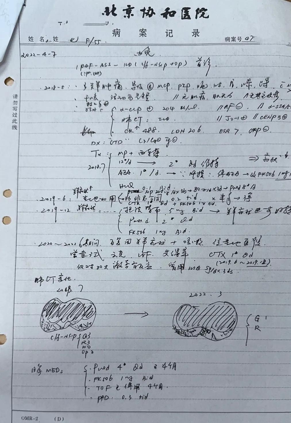 最近有个病人赶来杭州浙大二院滨江院区，看了我周四下午的肺移植专家门诊，病人来自贵