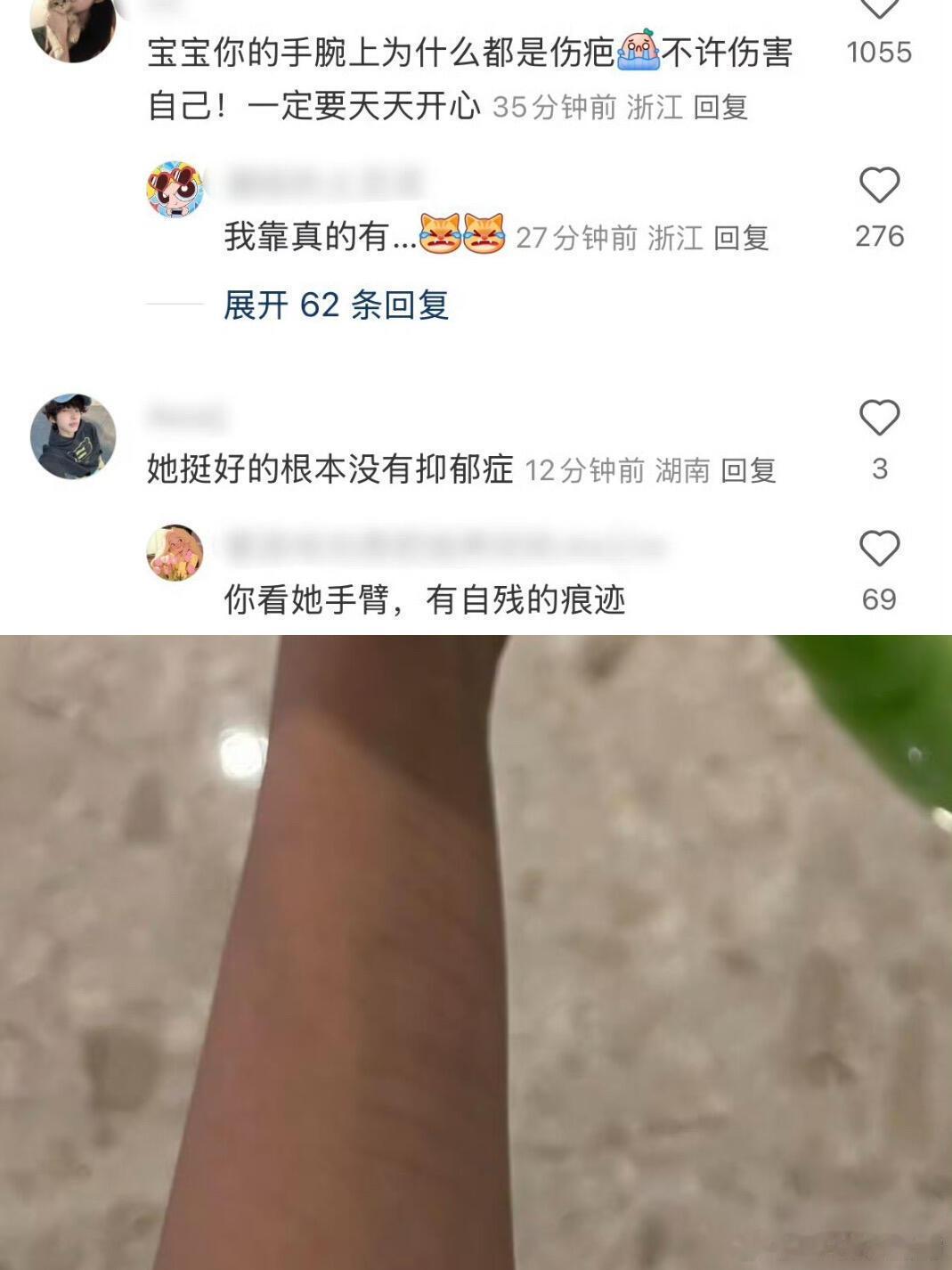 金子涵评论区有人注意到她好多伤疤她到底是怎么了，我记得看过她选秀前在美国拍的跳舞