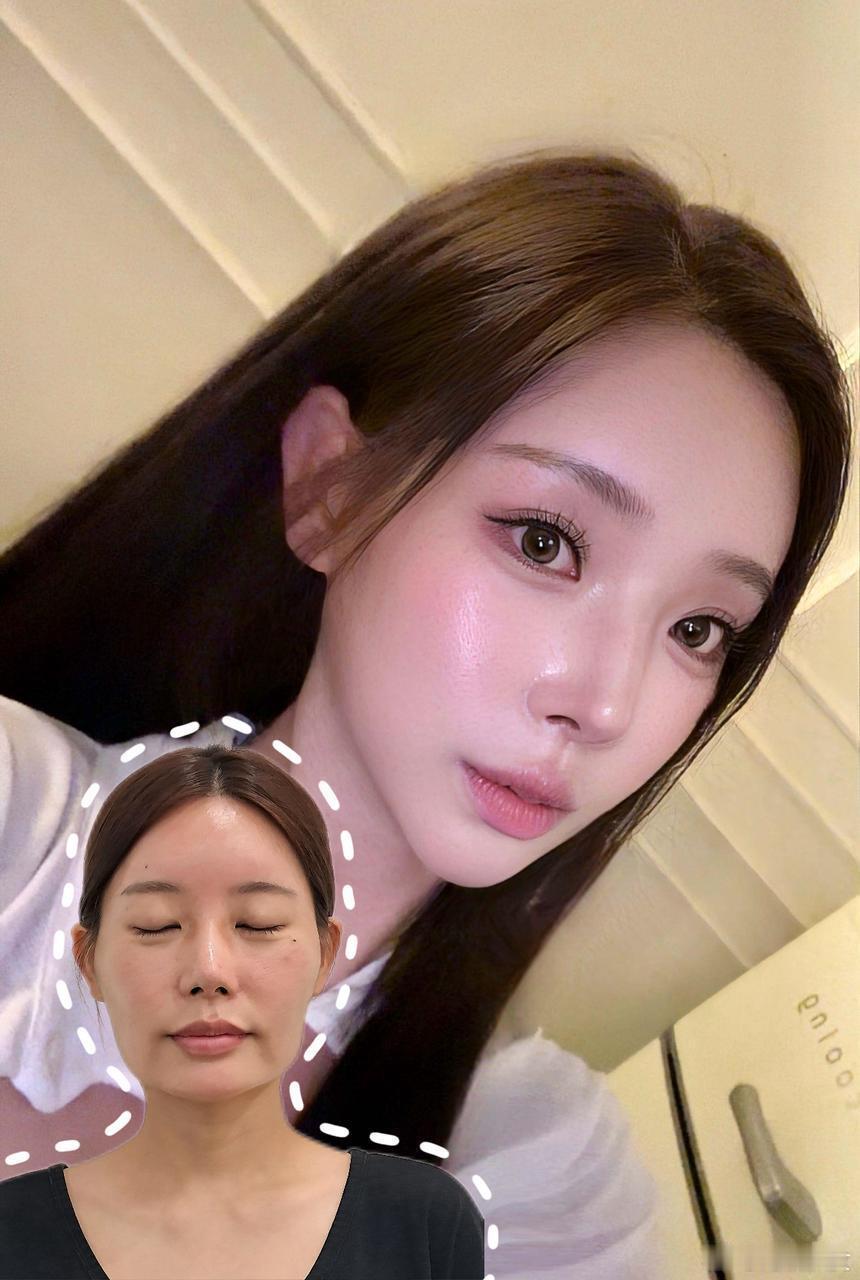 终于get到自己的的梦中情脸了细节控就是容忍不了这个电视机脸型，尤其是上镜之后更