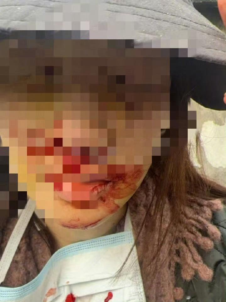 警方通报金晨事件隔了这么久，终于回应了！不过问题不大，大大方方承认了错误，也未造