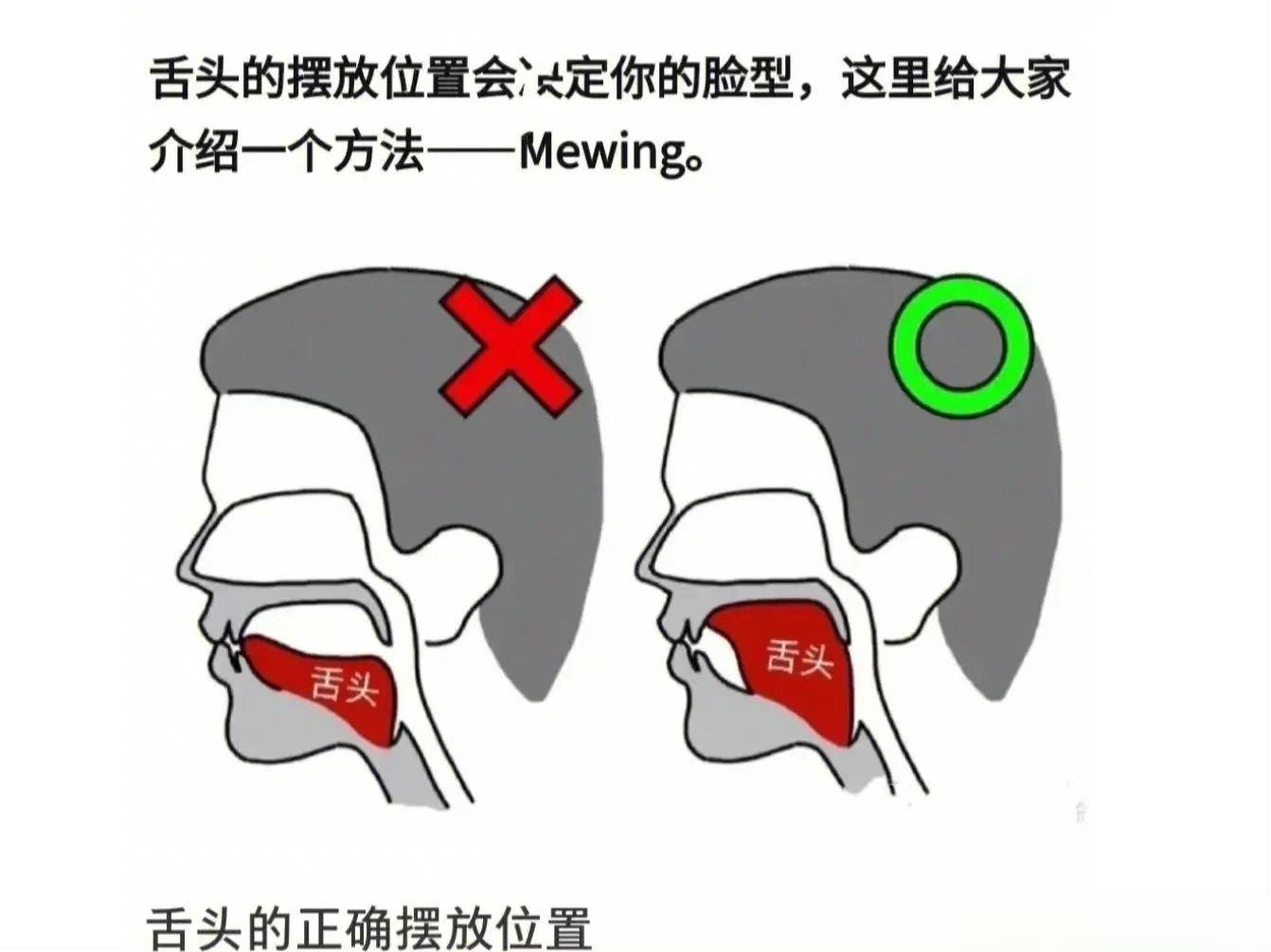 #别再把舌头垫在牙齿中间了#上次存的，我到现在还不能把我双下巴收回去，总是忘了整
