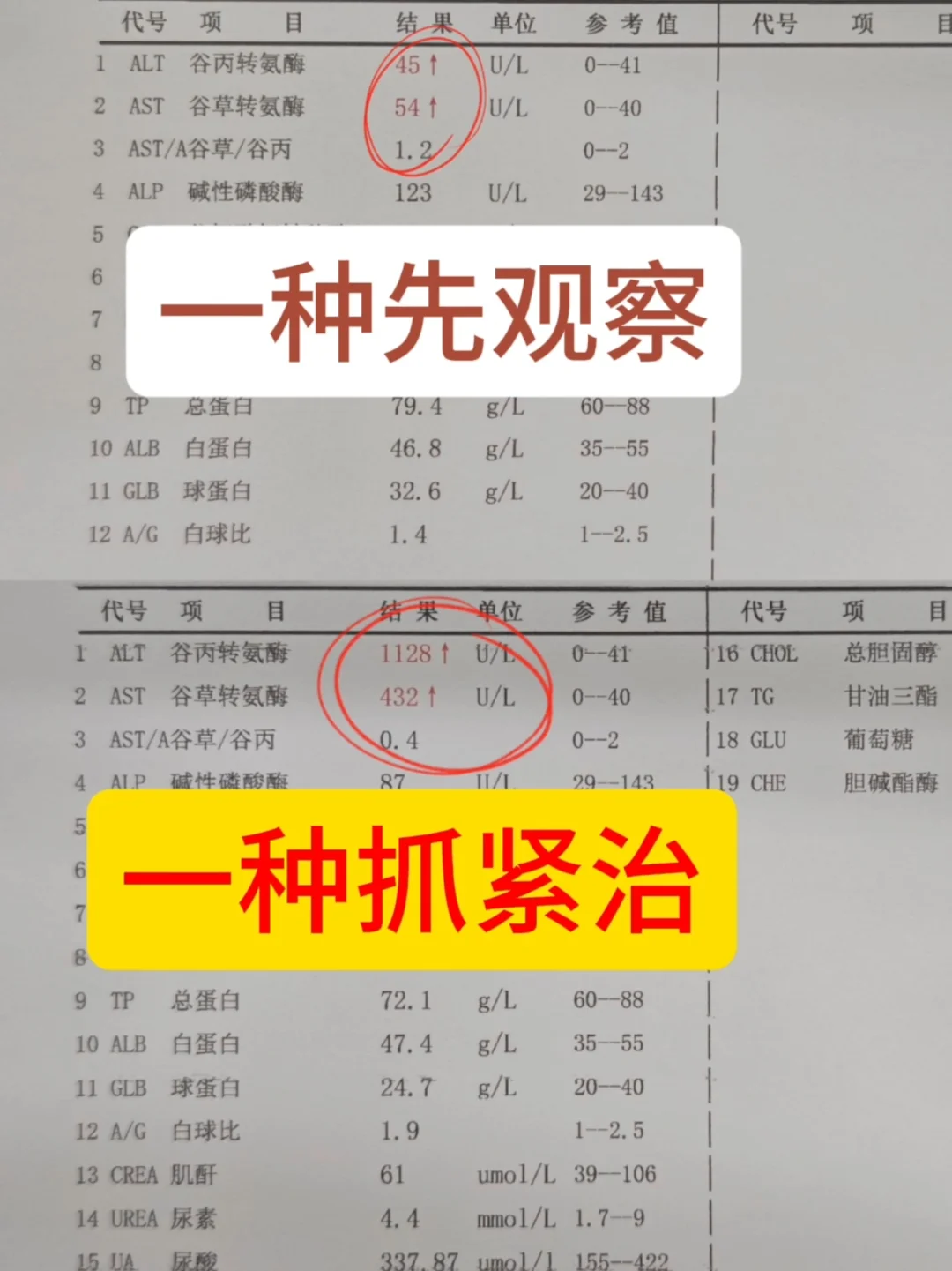 [爆炸R]办健康证发现我转氨酶高，会不会影响到我跑外卖[石化R]？ 	...