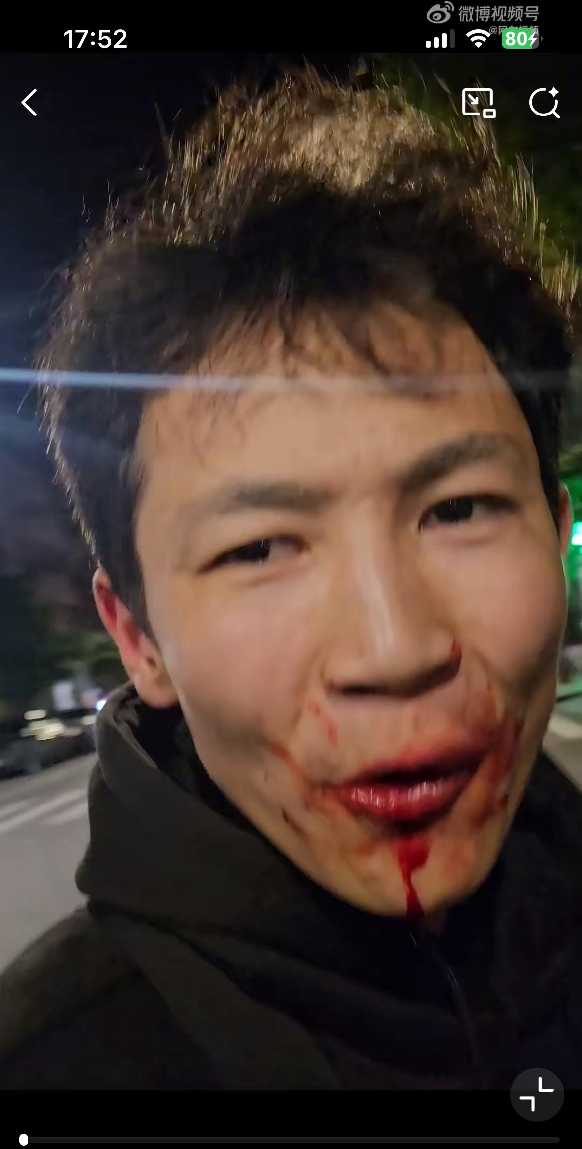 几名中国游客在亚美尼亚街头遭遇十几名歹徒持刀抢劫，幸得一路过哈萨克斯坦小伙挺身而