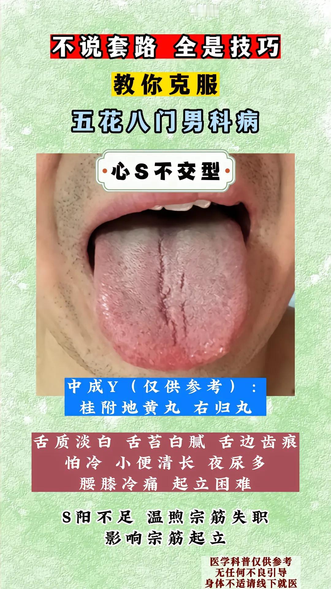男科有没有障碍，瞅一眼舌象就知道！肾阴虚型、肾阳虚型、肝郁气滞型、心肾不交型、湿
