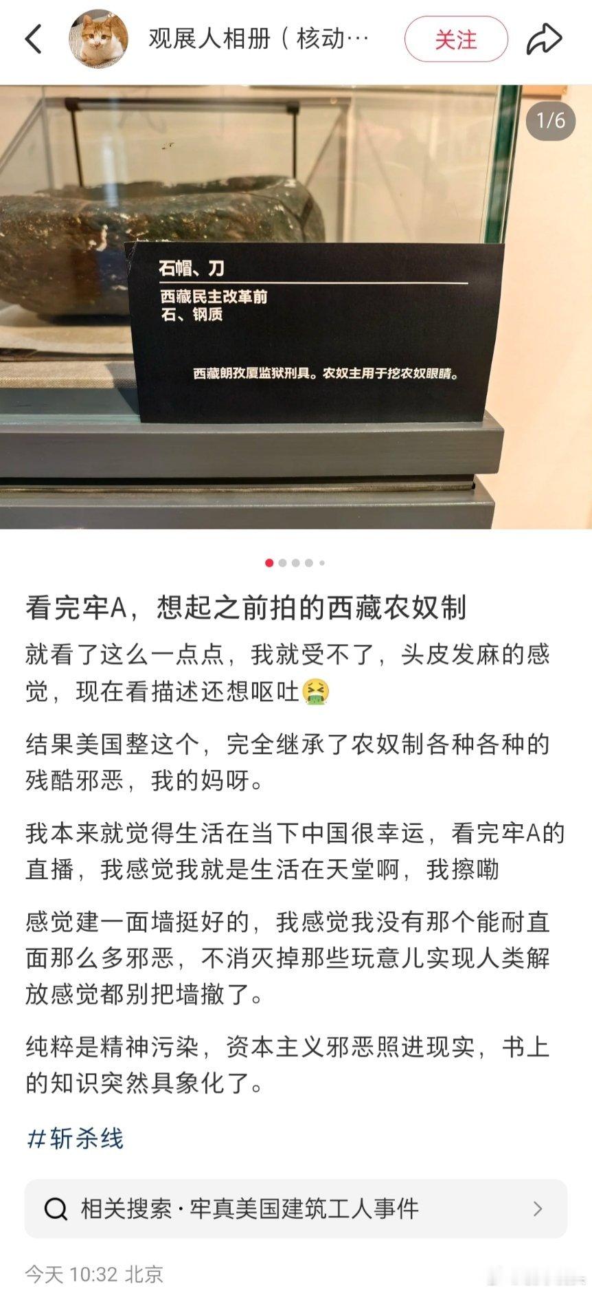 美媒印证了牢A的捐献器官说法牢A揭露的美国日常直接把所谓的超级大国的底裤都给扒了