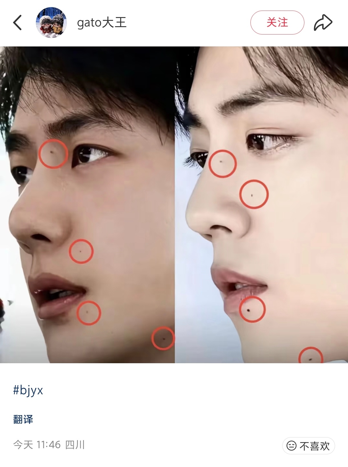 我勒个豆，怎么痣也越长越像了