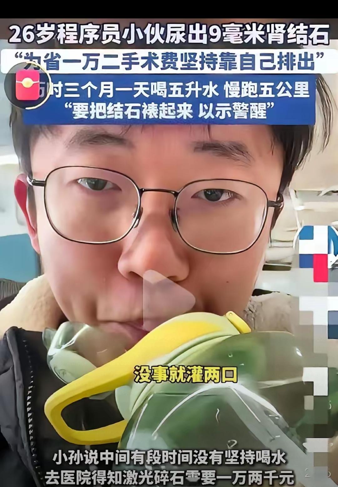 见过狠人，真没见过这么狠的！山东26岁小伙，硬生生靠自己的狠劲，把9毫米的肾结石