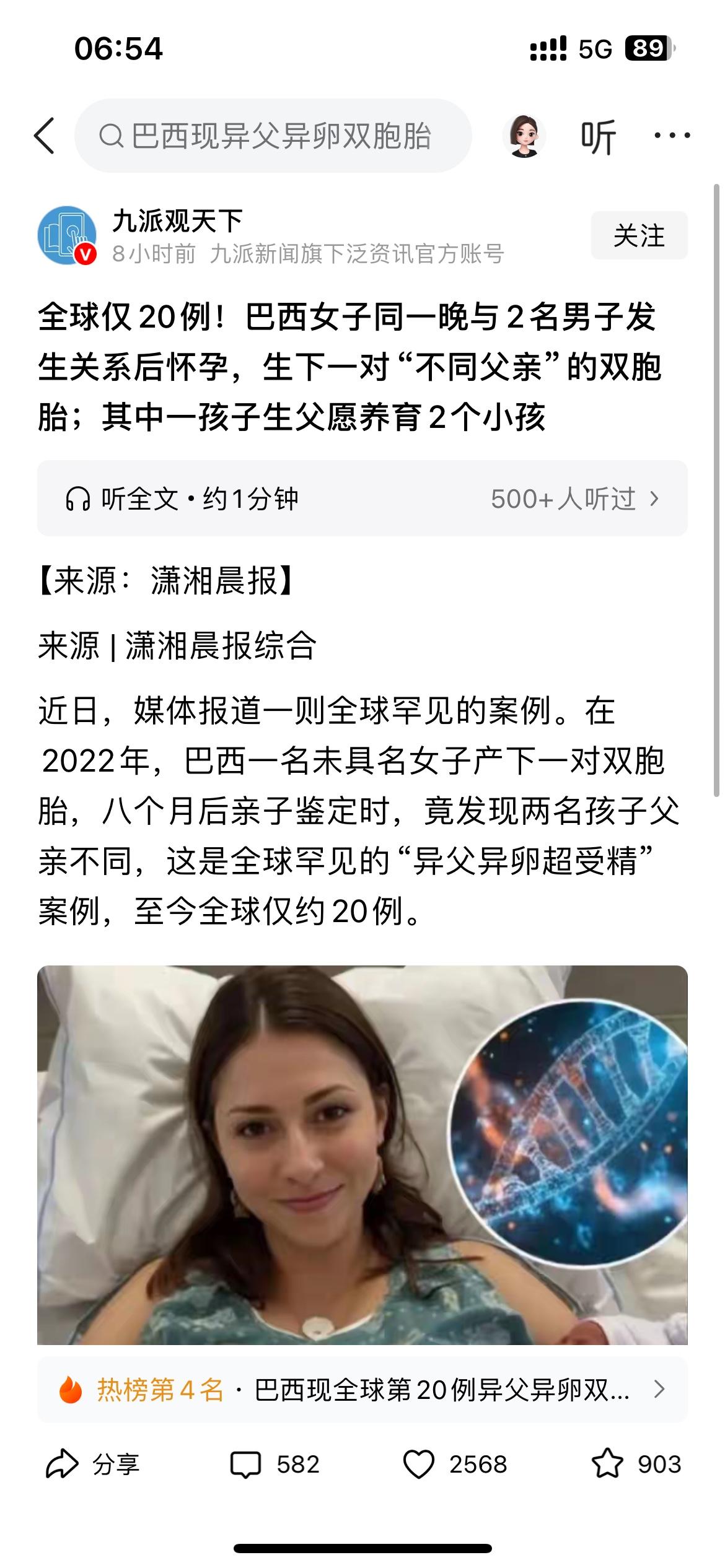 目前全球仅20例“异父异卵超受精”体，就是“双胞胎是不一个爹”，这可真是超级“奇