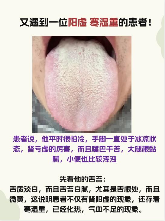 今日舌象分析