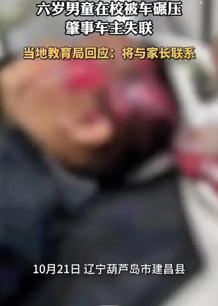 6岁男孩在学校被车碾压，导致“头骨暴露”，事故车主突然失去联系，教育局：联系家长