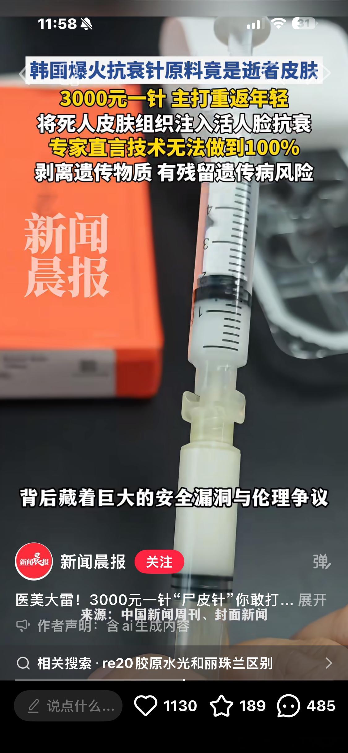 有病吧我超！真的还是假的我尼玛打得就是这个re20，怎么好端端变成si人皮肤了？
