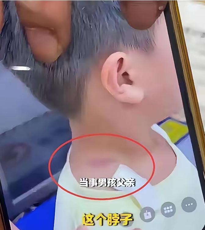 掐住4岁孩子脖子的她，不是“公主病”，而是大脑不受控
一个4岁的孩子，被一位年轻