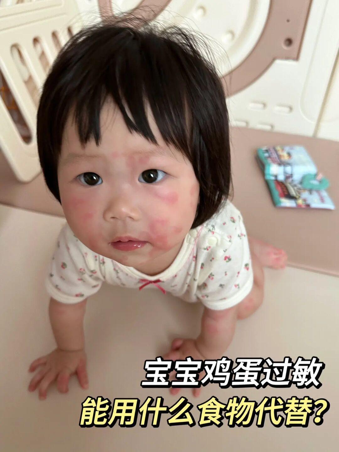 宝宝辅食|鸡蛋过敏用什么食物可以替代呢？