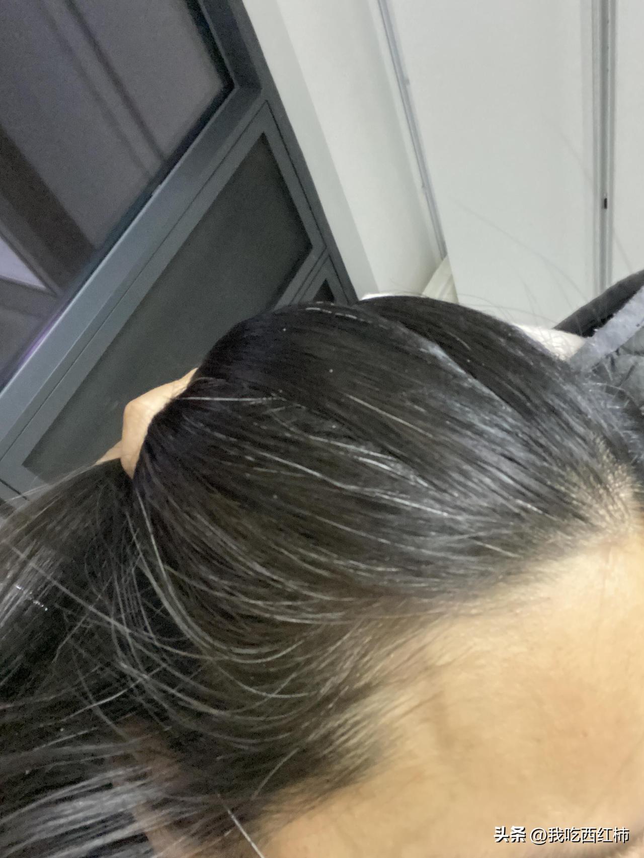 41岁长了很多白发
40岁被裁，找了个便宜工作半年又裁员，又换了个工作，累，回家