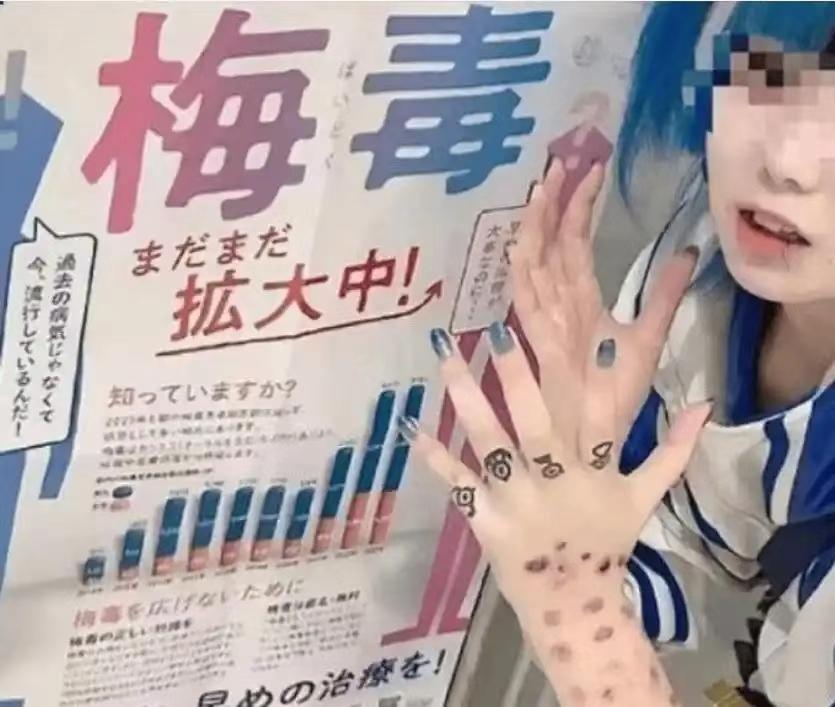 日本梅毒彻底失控，暴涨1114%！
最可怕的一幕来了！

很多人可能还不知情，日