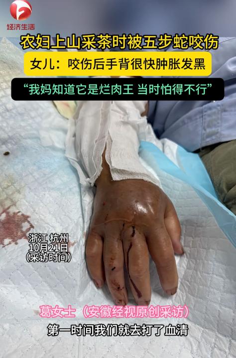 死里逃生！10月21日报道，浙江杭州，一女子上山采茶叶时，忽然感觉手被扎了一下，