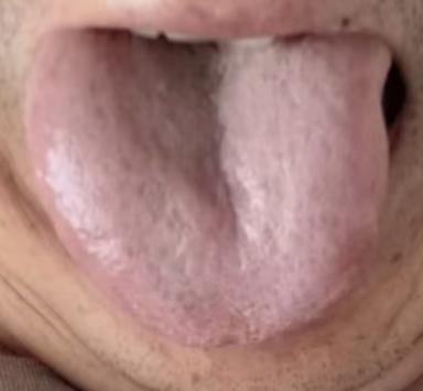 下身潮湿发烫？多为肾精亏虚、湿热下注所致







近期收到一位粉丝的提问：