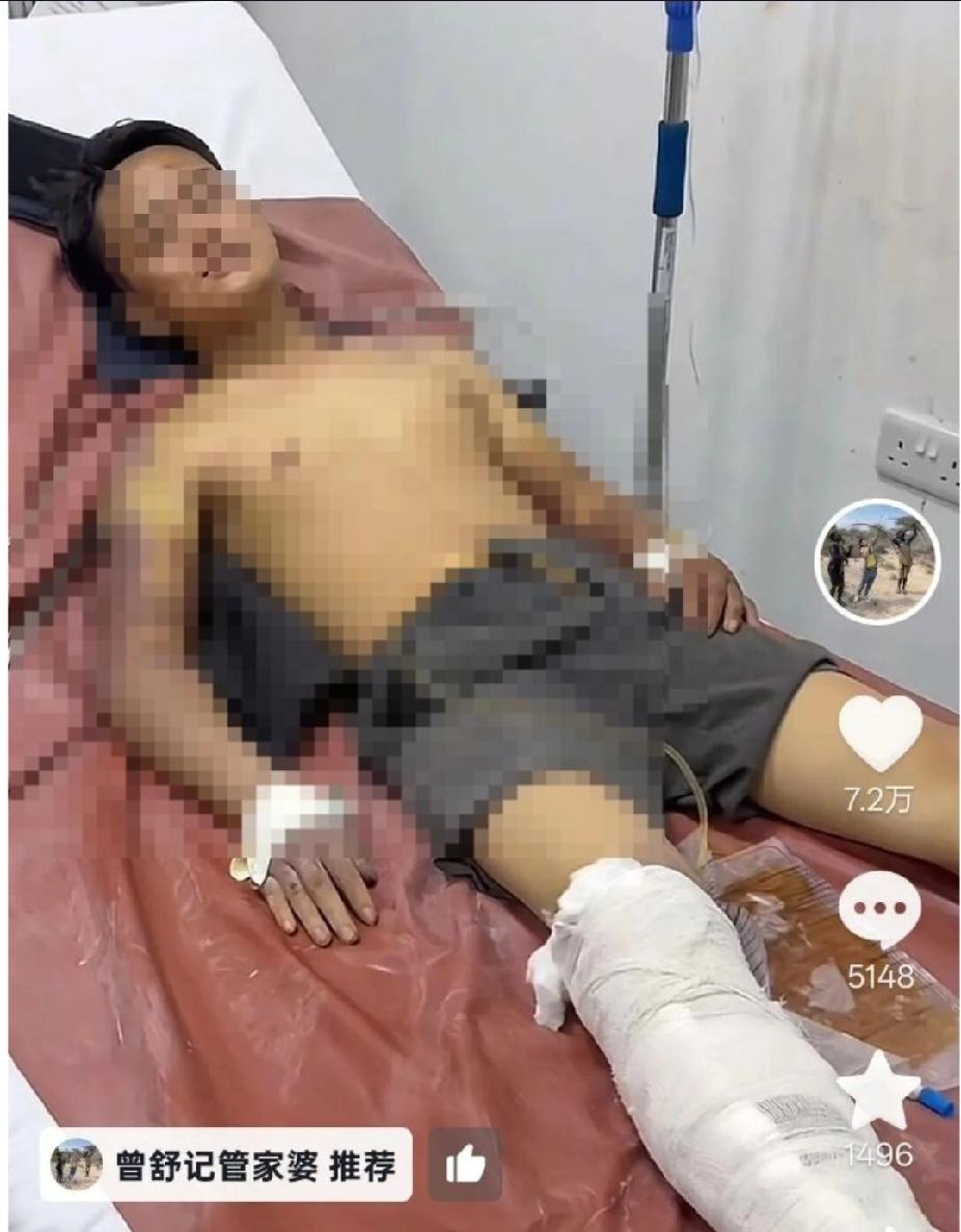 27岁的自媒体博主曾先生在坦桑尼亚遭遇了令人发指的绑架和殴打，导致他至今无法行走