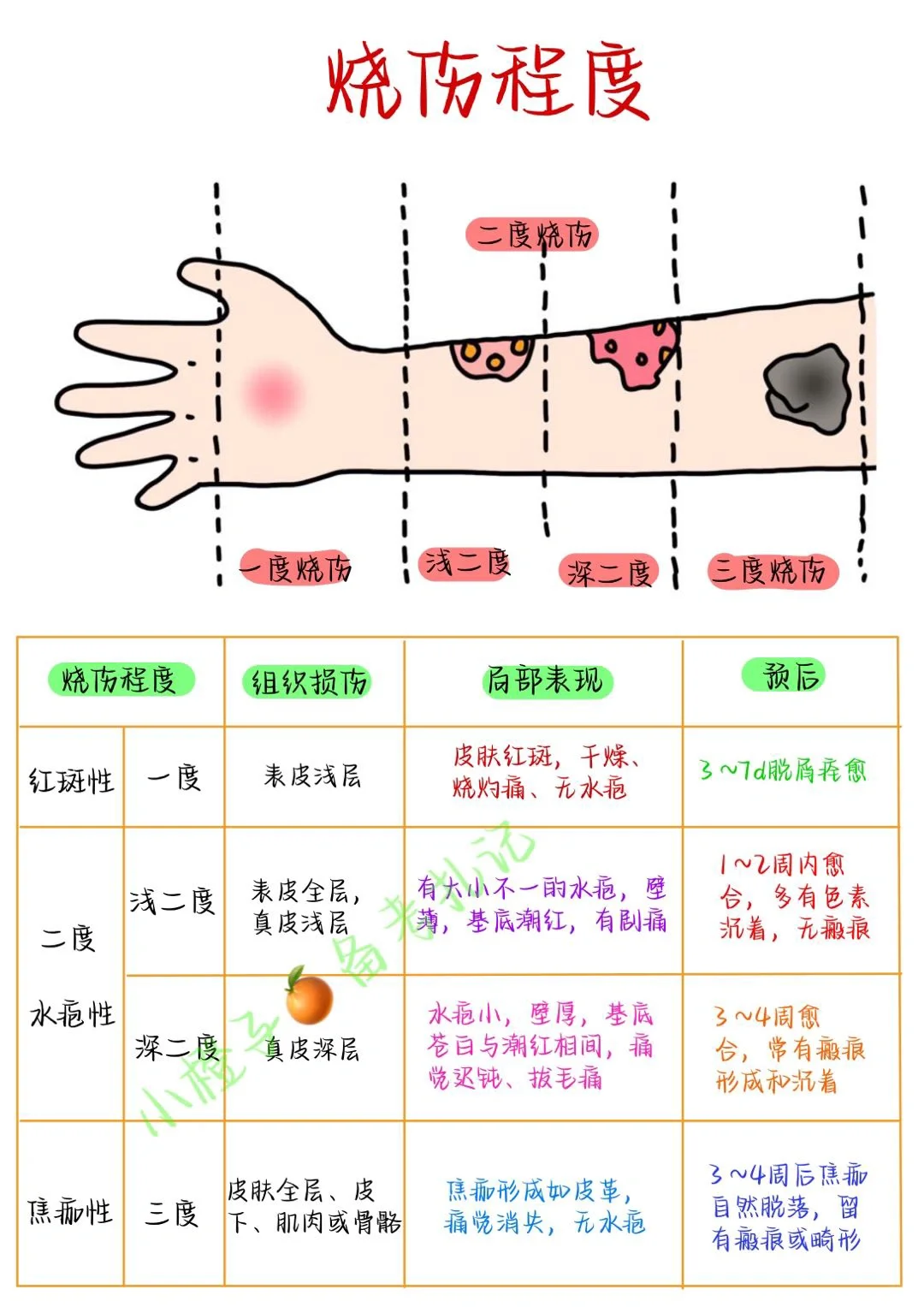 📖考试笔记｜烧伤程度｜烧伤补液计算✅