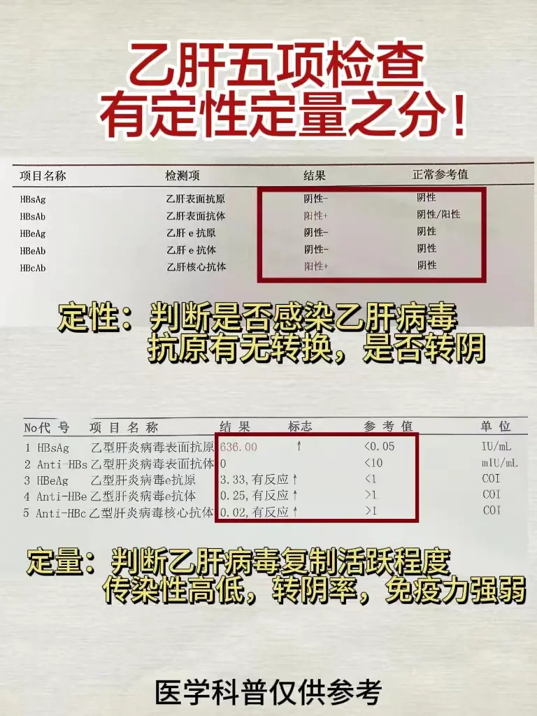 乙肝 医学科普 山东 肝病