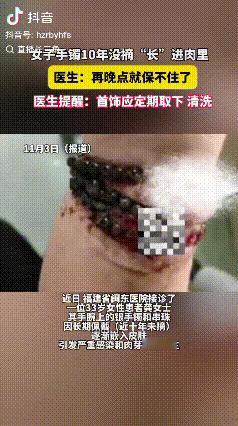 “万万没想到！”福建宁德，一33岁女子手腕上戴的首饰，10年几乎没有摘下来过，由