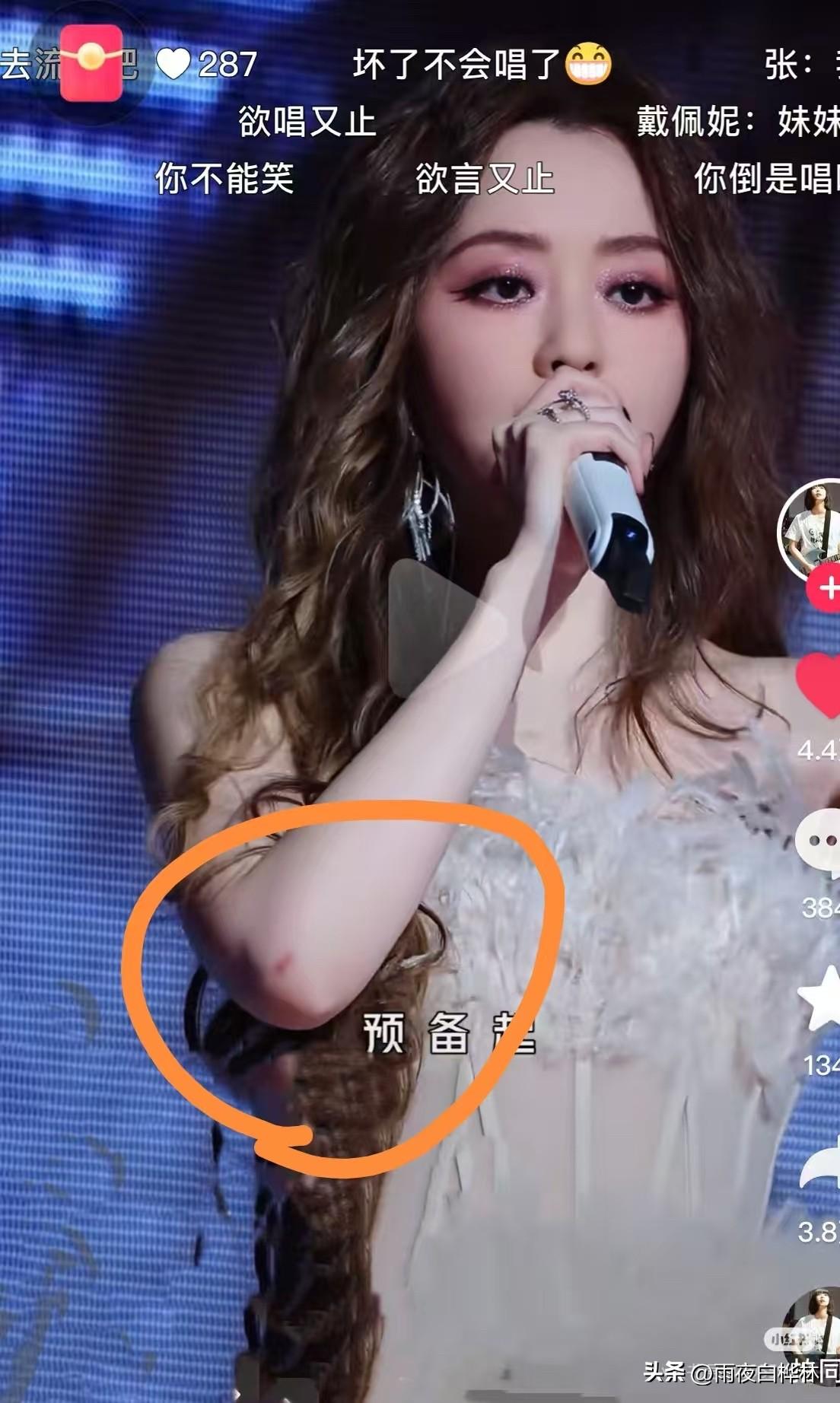 张靓颖打不打针，无所谓了，
张靓颖笑不出来，也无所谓了，
我唯一关心的是，张靓颖