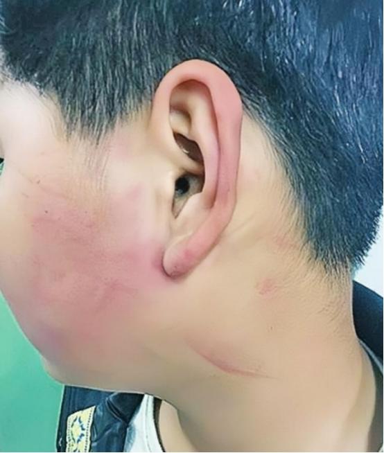 2019年，四川一名校长，因学生调皮，扇了他几巴掌，被孩子母亲逼着赔礼道歉。不料