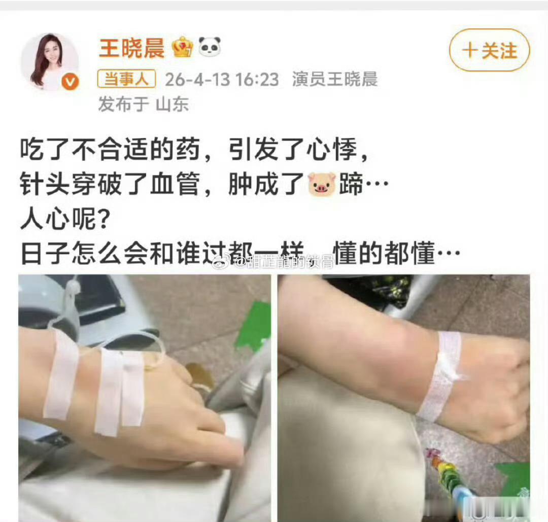 王晓晨俞灏明就医心理科这是怎么了？不过重视心理健康很重要 