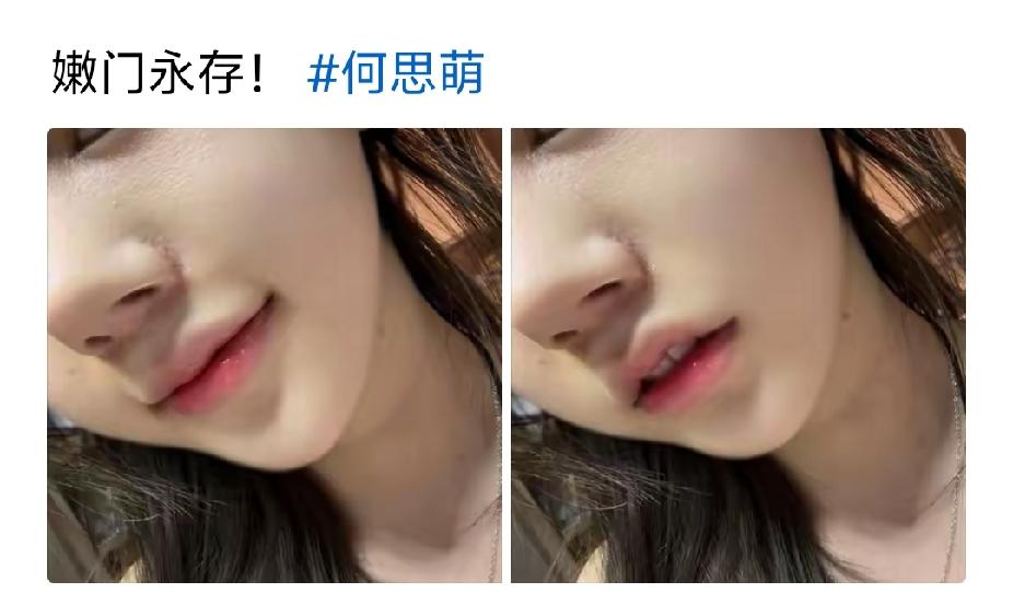 好像是鼻翼皮肤处感染了皮炎 有隆起和增生的迹象。 如果是感染了 姑娘 注意你的化