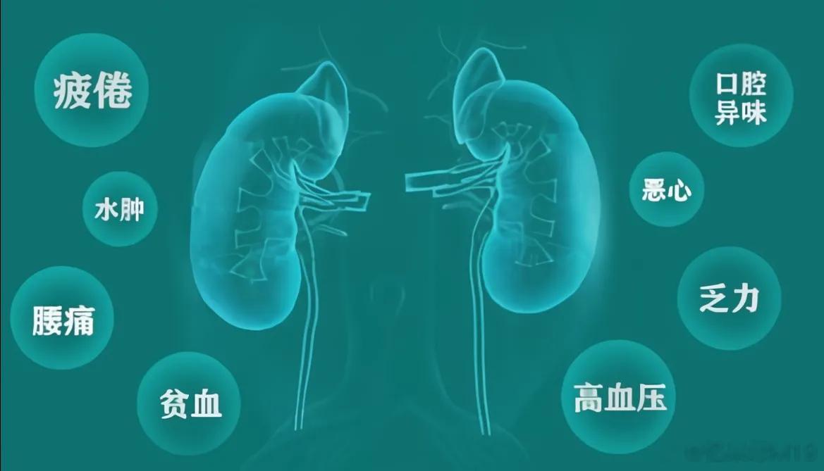 肾病这3种并发症，可千万小心1、肾性贫血严重贫血主要发生在肾衰竭、尿毒症阶段。主