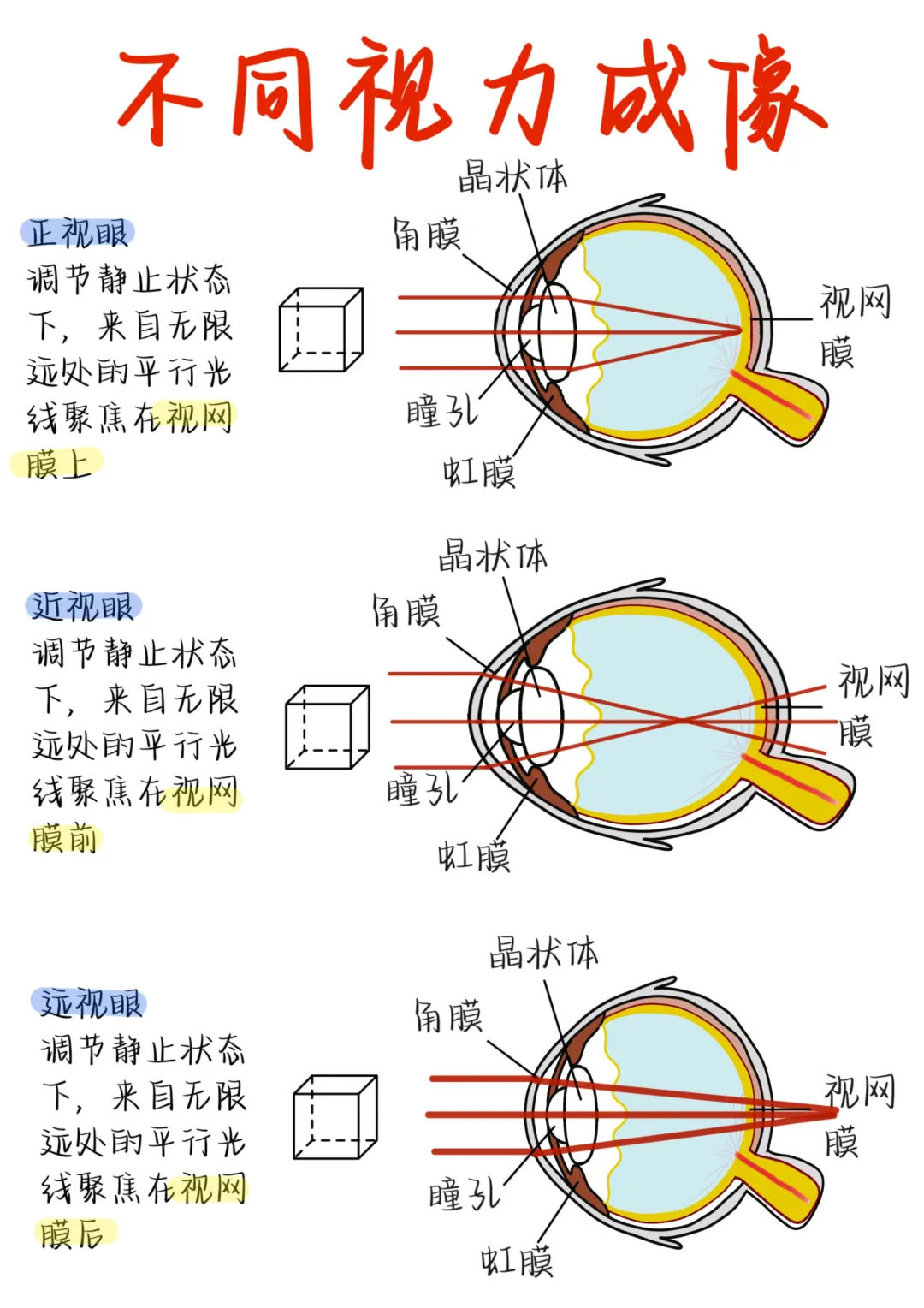 医学生笔记——不同视力成像