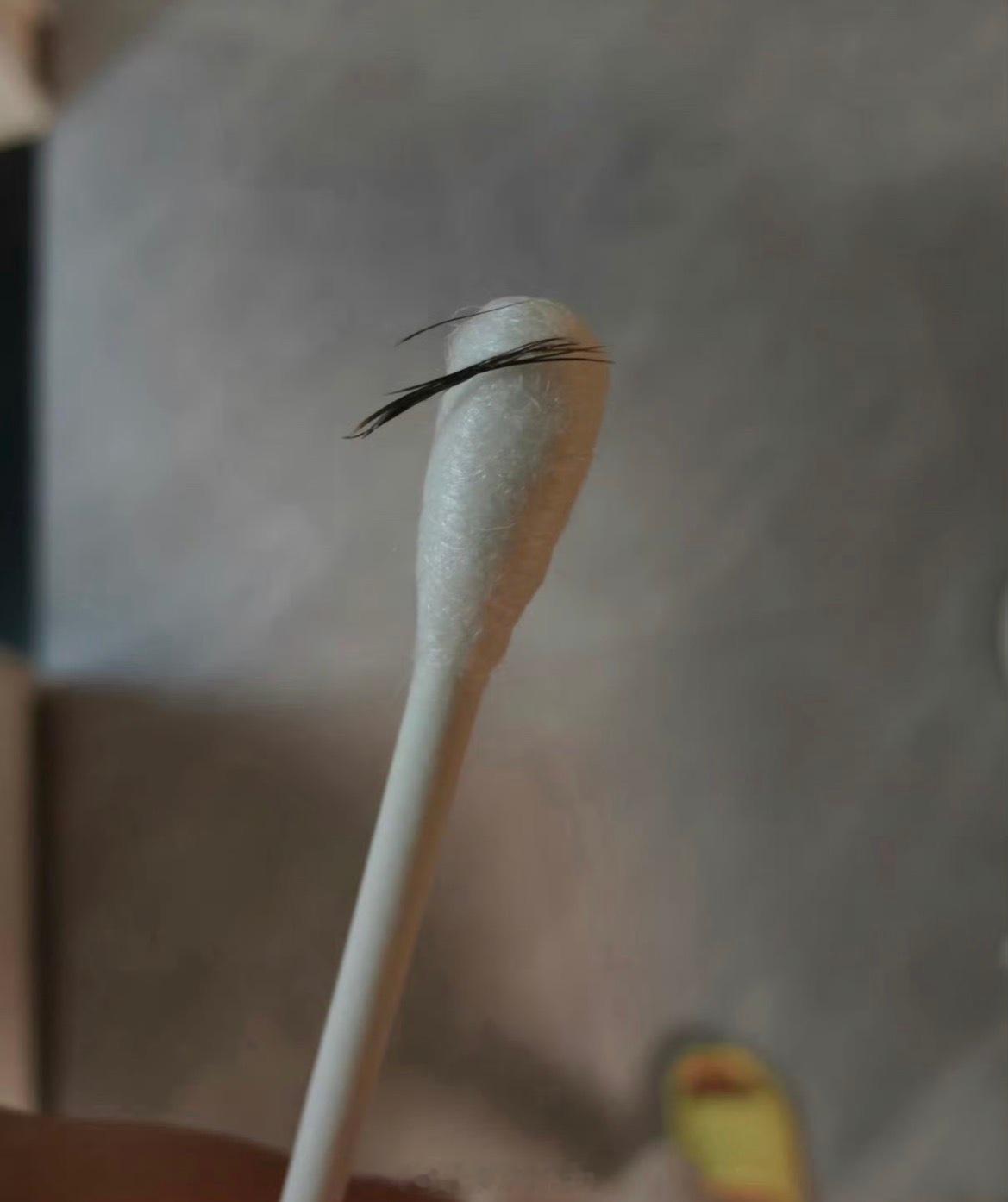 睫毛没把自己当异物 这样的吗？为什么我一有睫毛掉进去眼睛就痛得不行，异物感特别强