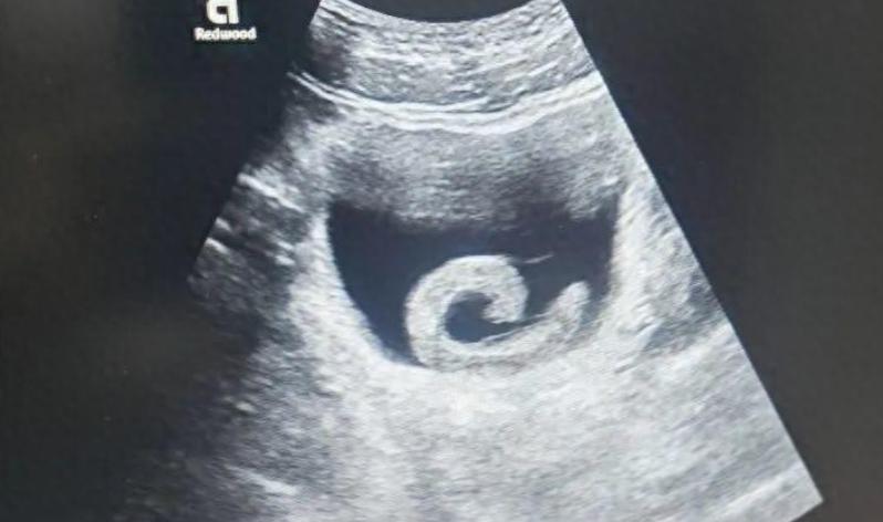 是个狠人！河南郑州，一名23岁的小伙子，因为好奇心和一点猎奇心理，做了一件令人难