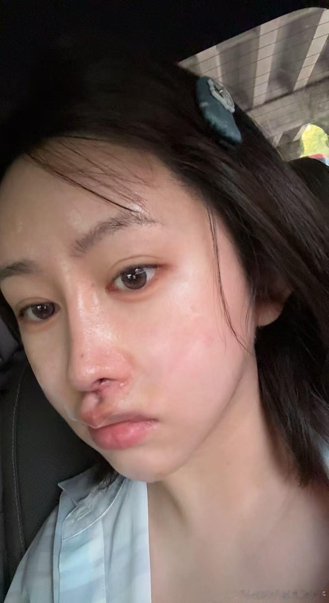 我去年脸好紧好轻薄 今年是怎么了 越来越拉垮 好像今年没有做大仪器抗衰 