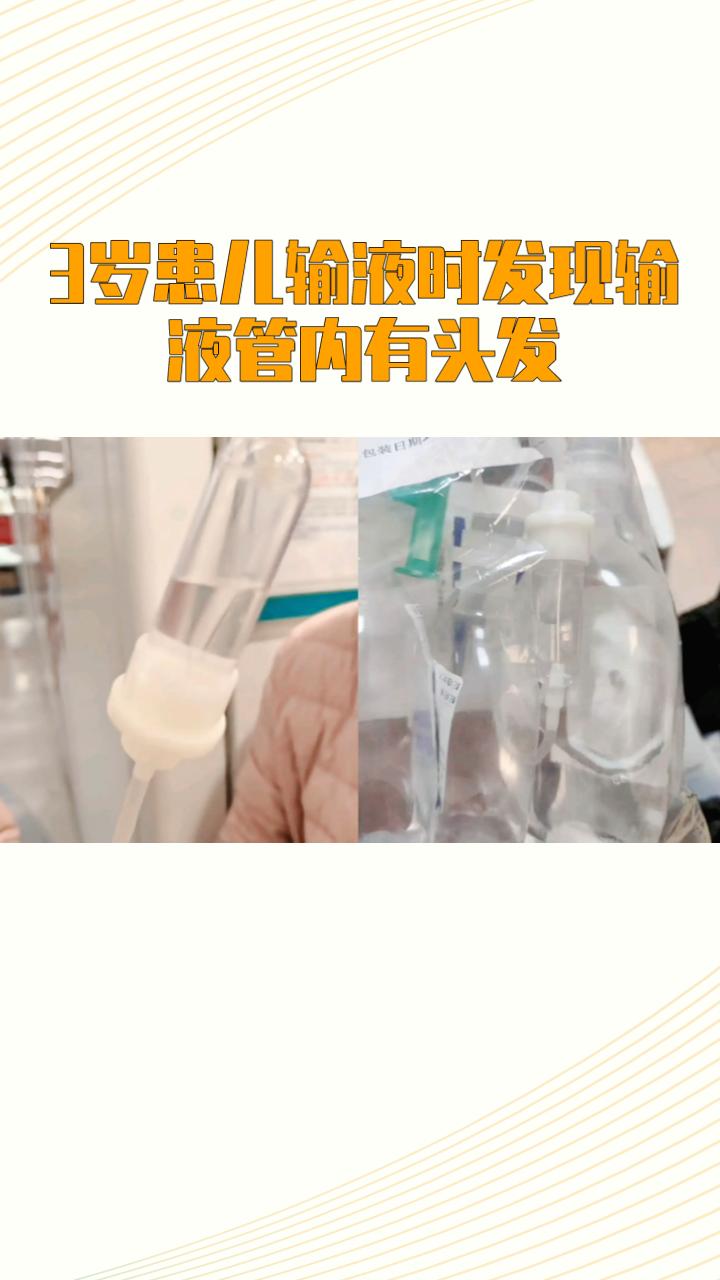 三岁患儿输液时发现输液管内有头发，引发家庭与医院之间的医疗纠纷。
近日，市民殷先
