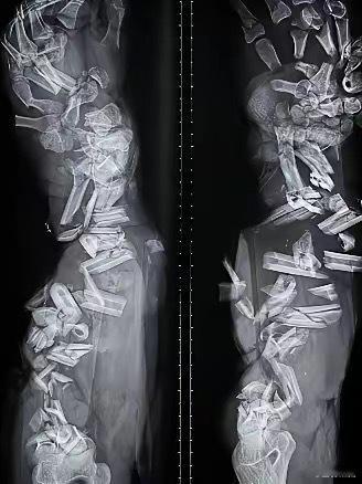 这个状况怎么救 ​​​