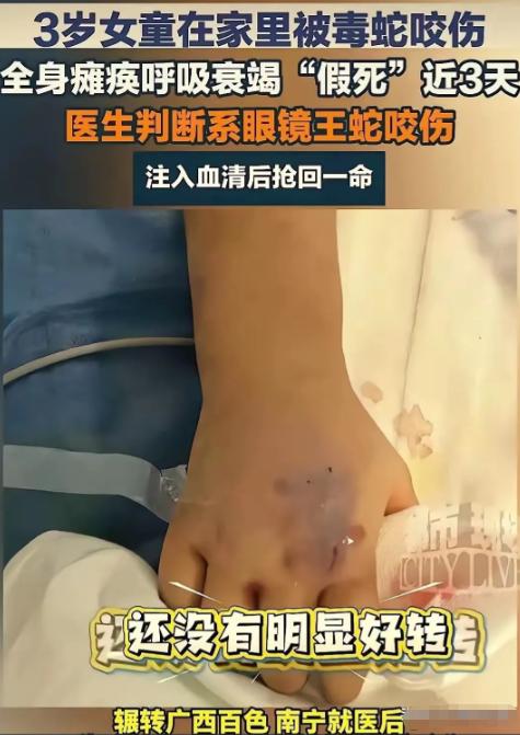 “真是奇迹！”云南文山，一3岁女童在家中意外被毒蛇咬伤，送医仅半小时，孩子已全身