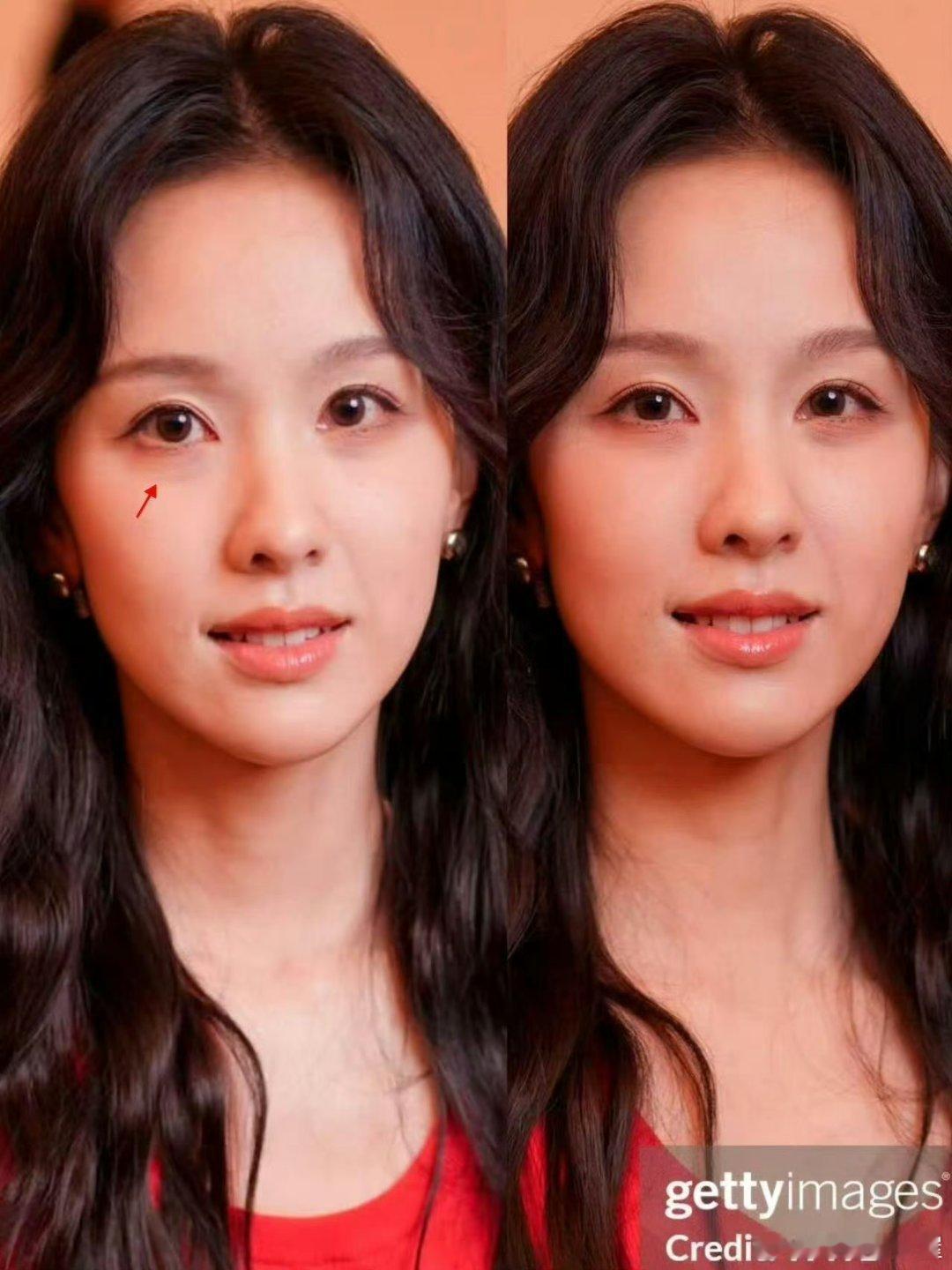 陈都灵眼袋美女有眼袋就有呗，这么不明显的生图眼袋也要放大看 ​​​