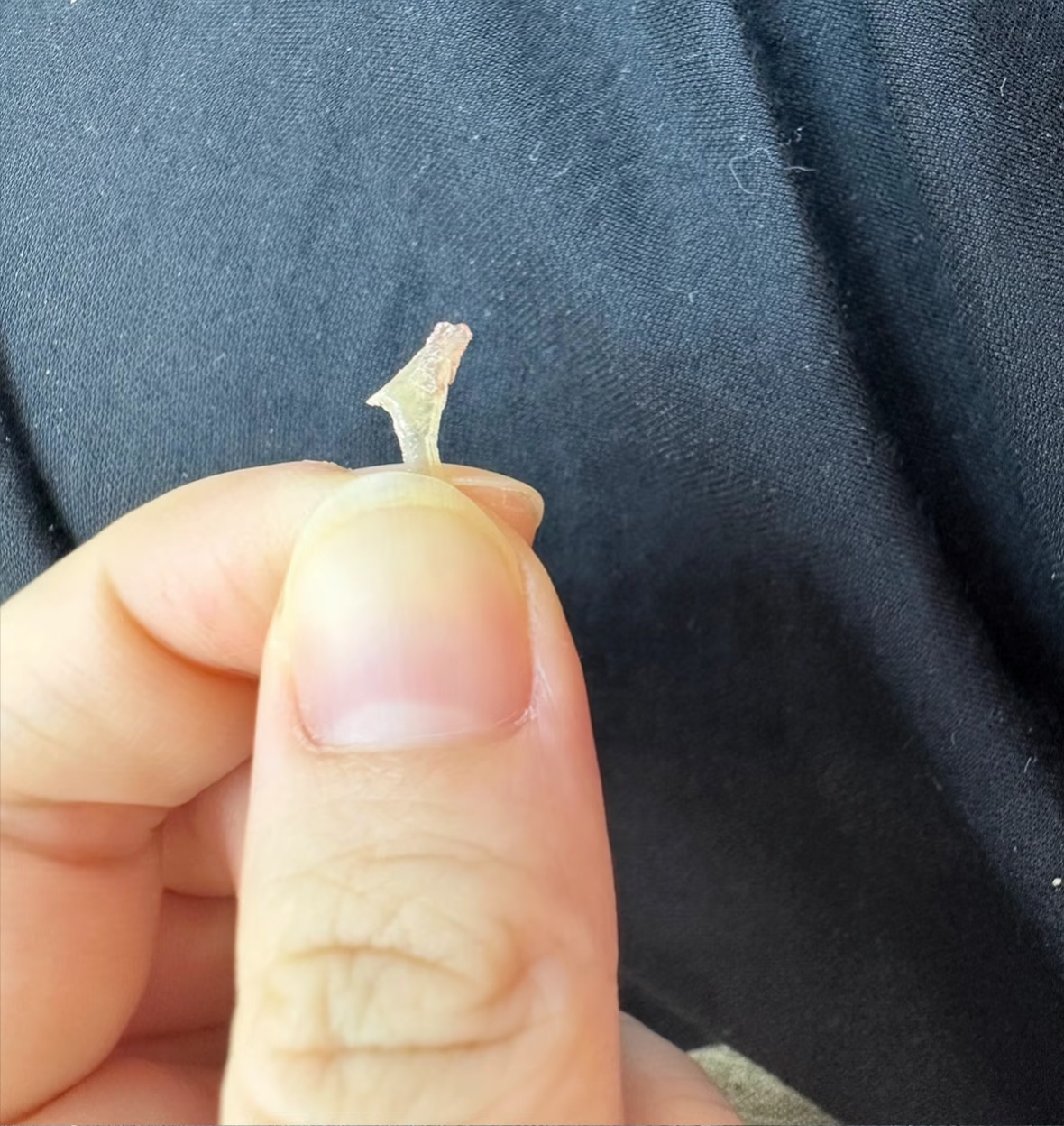 就是这个鬼东西，使我不得开心颜！狠心拿了修甲剃刀沿着指甲侧边一路切下去，撬出来这