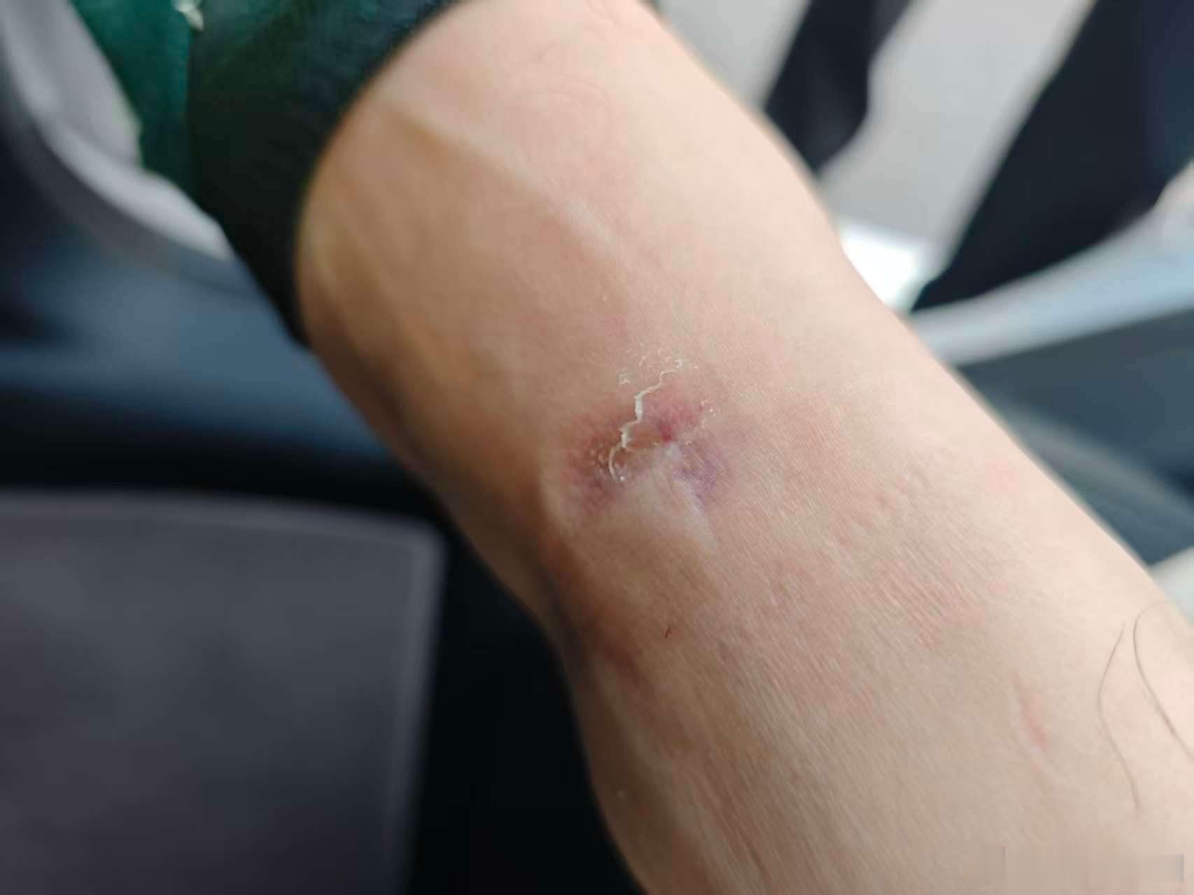今天在群里看到了这个留言，都不知道说什么好。大家去尝试的时候，千万玩座椅的时候要