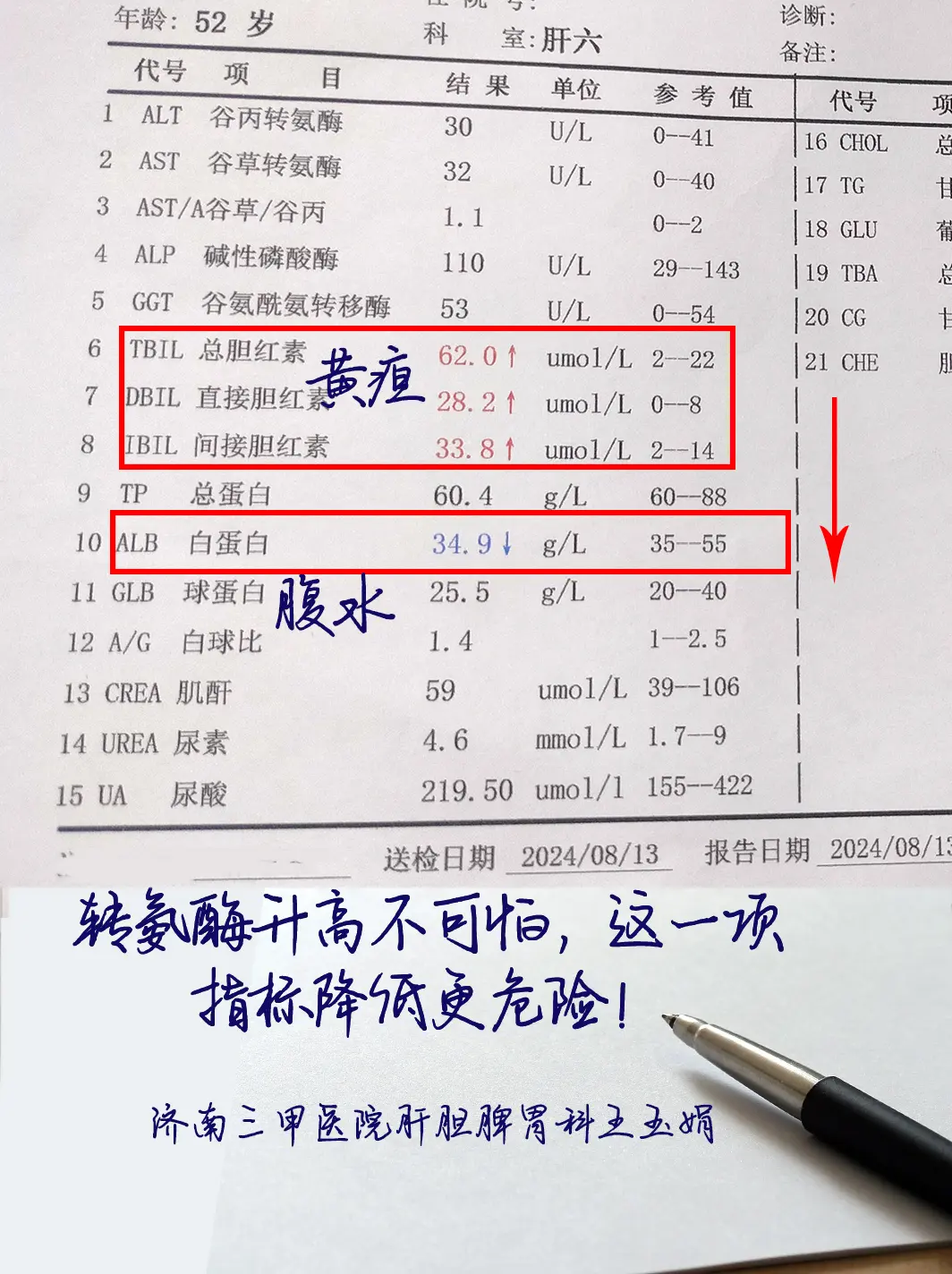 大家看一下这是一位山东泰安的患者，52岁，谷丙和谷草都正常，但胆红素三...