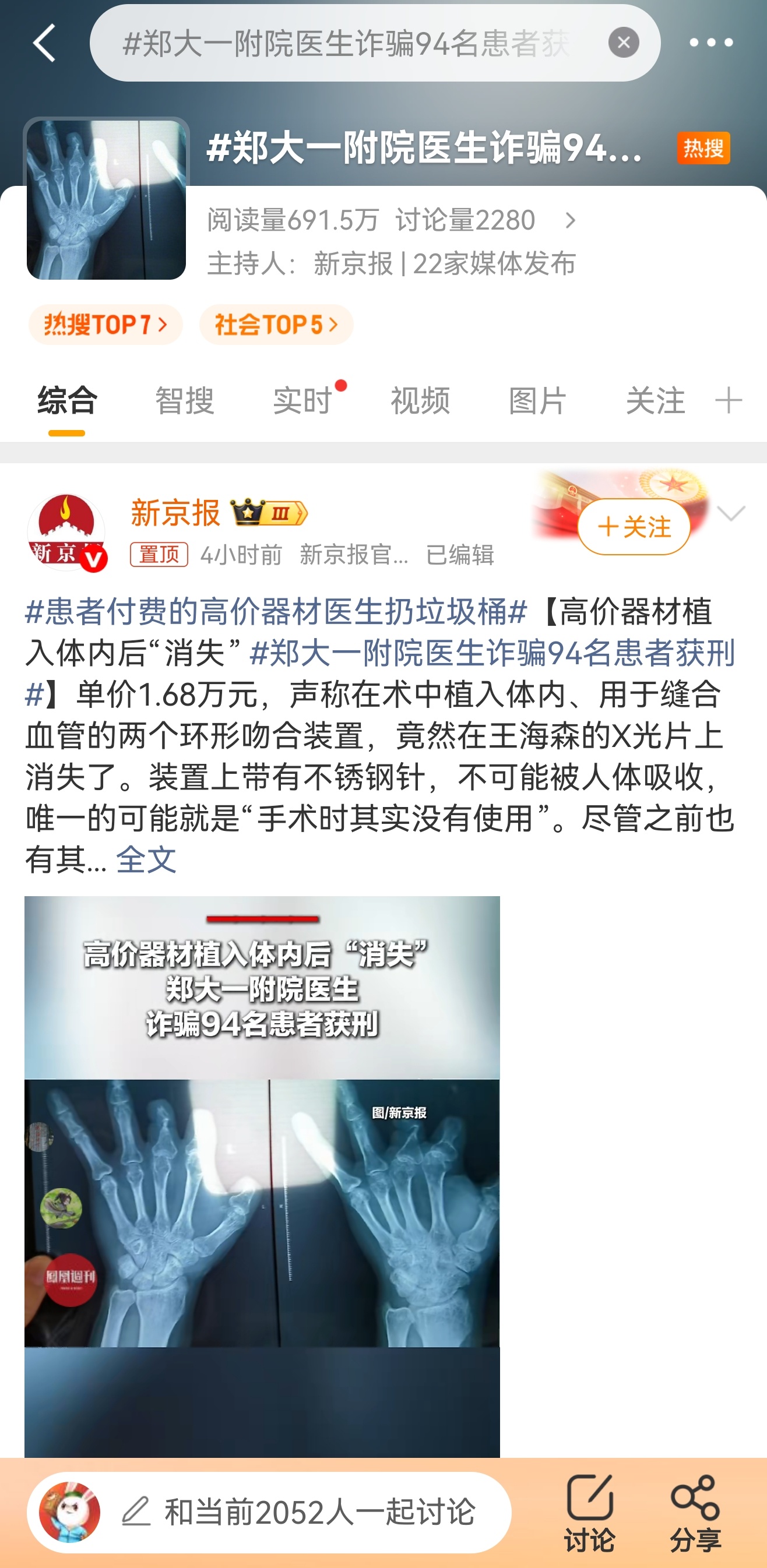 郑大一附院医生诈骗94名患者获刑划重点：早有患者投诉，医院却只是调岗，未能及时斩